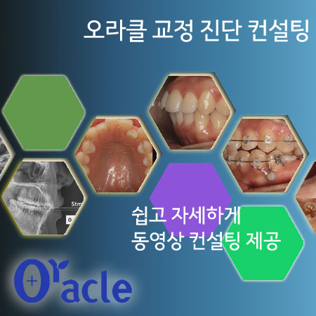 oracle_consultation oracle_consultation