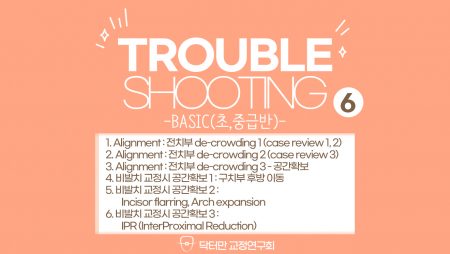 Trouble Shooting basic course 6회 (비발치 교정시 공간확보)