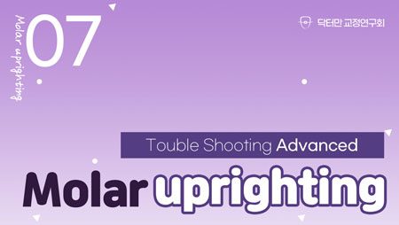 Trouble Shooting Advance course 7회 (Molar uprighting)
